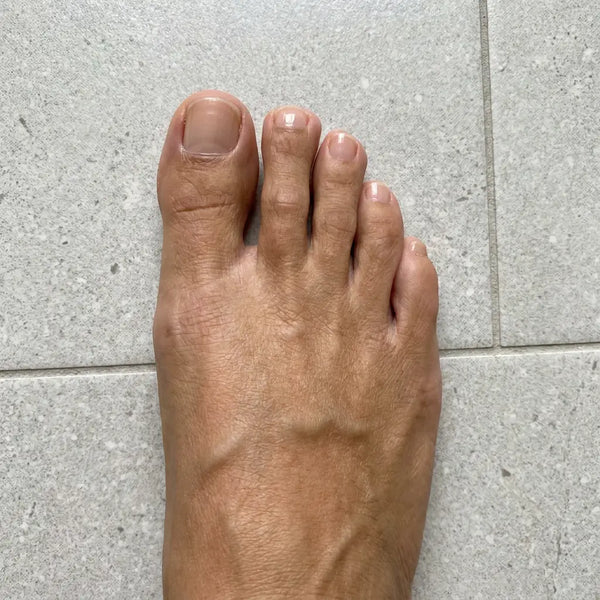 DOPO