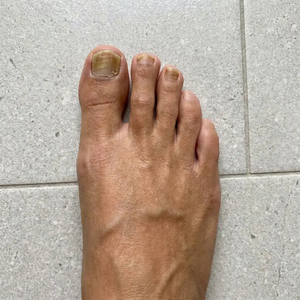 PRIMA