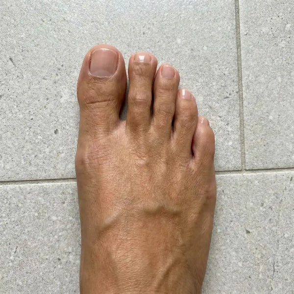DOPO